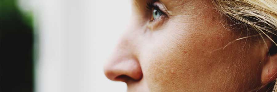 Neuscorrectie zonder fillers Neuscorrectie zonder fillers